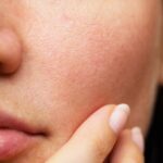 Top 7 sai lầm dễ mắc phải khi dưỡng da khô